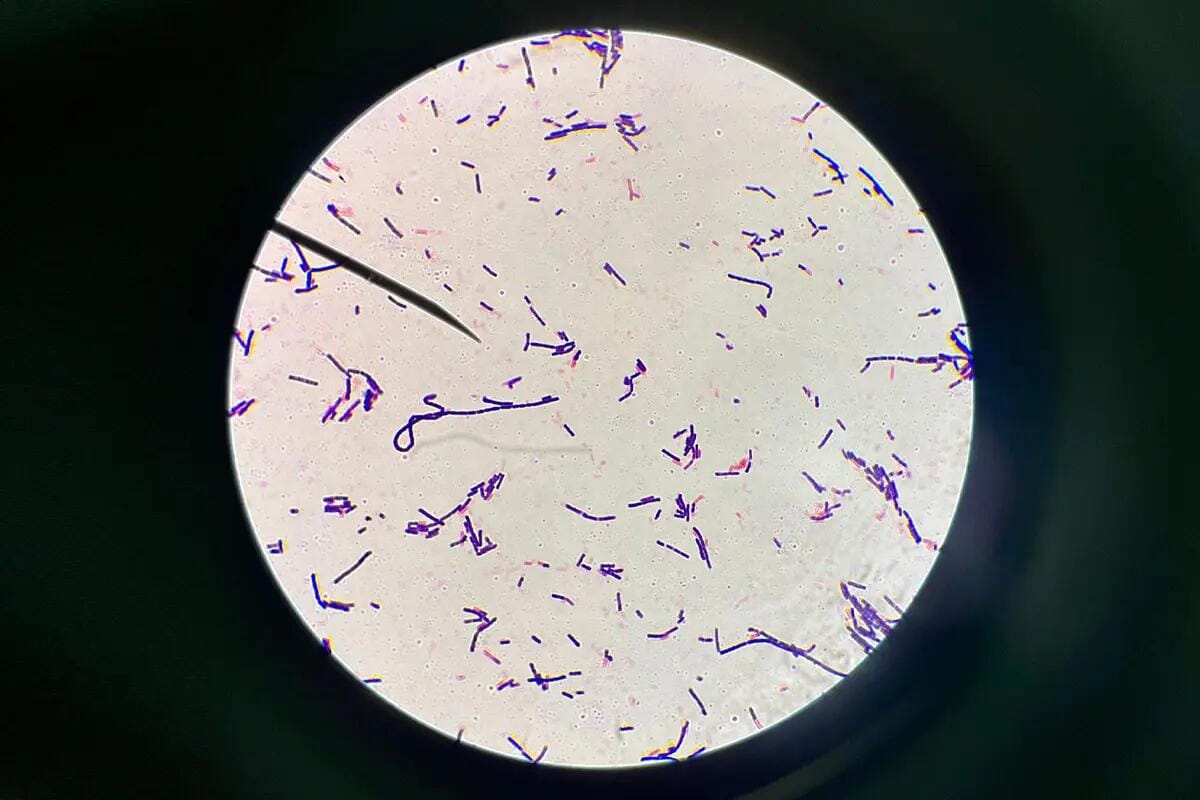 New Study Shows Covid-19 Vaccines Greatly Weaken Important Gut Bacteria And Biodiversity